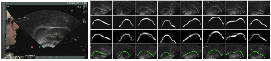 Ultrasound Tongue Contours